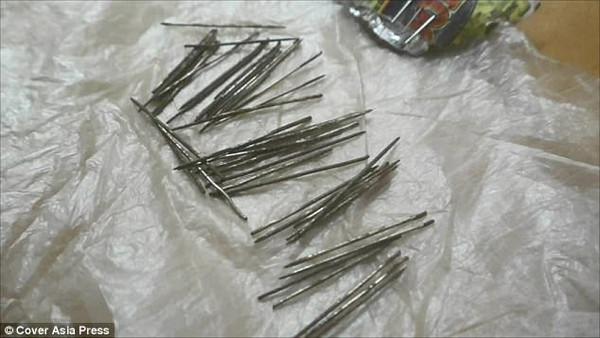 Kỳ lạ người phụ nữ 'sản xuất' cả vốc kim, đinh nhọn trong chân ảnh 4