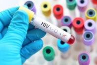 Kết quả HIV dương tính, bệnh nhân ngã ngửa khi biết mình mang “bóng ma” của mọi thời đại