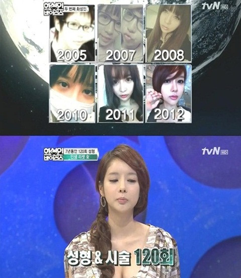 Cô gái Hàn Quốc phẫu thuật 120 lần trong 7 năm 