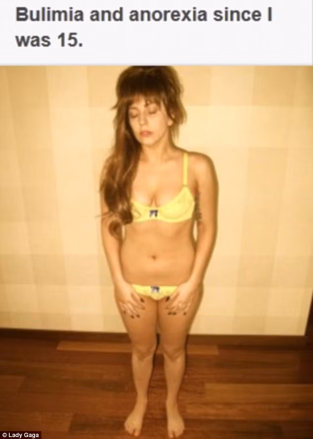 Sau khi những hình ảnh của cô được đăng tải, rất nhiều lời chê bai về việc Lady Gaga ngày càng béo ú khiến cô bực mình. Nữ ca sĩ đã lột đồ và chỉ mặc duy nhất bộ bikini bé xíu rồi chụp ảnh và tự đăng lên trang web của mình để 