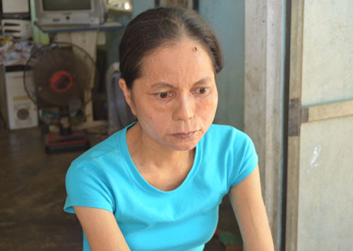 Mới 29 tuổi nhưng chị Mai lại mang gương mặt bà lão mặc dù được chữa trị nhiều nơi