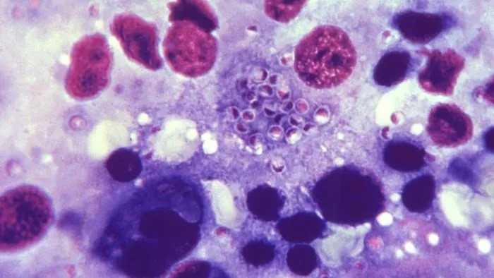 Hình ảnh kính hiển vi của loại nấm gây bệnh histoplasmosis.(Ảnh: CDC/Tiến sĩ Lucille K. Georg qua CDC PHIL)