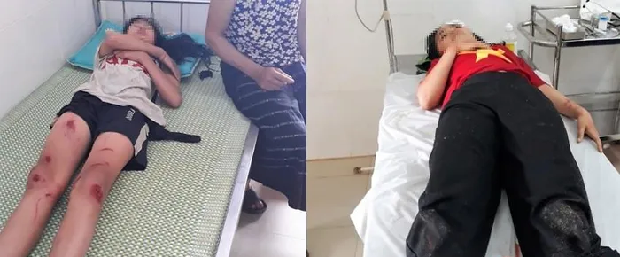 Hai học sinh bị thương đang được điều trị tại bệnh viện