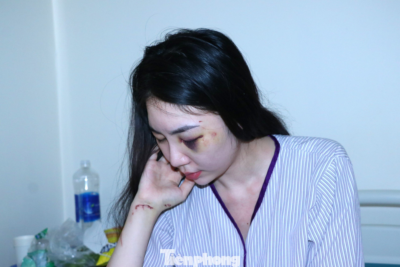 Chị T. hiện đang điều trị tại bệnh viện trong tình trạng bị đa chấn thương