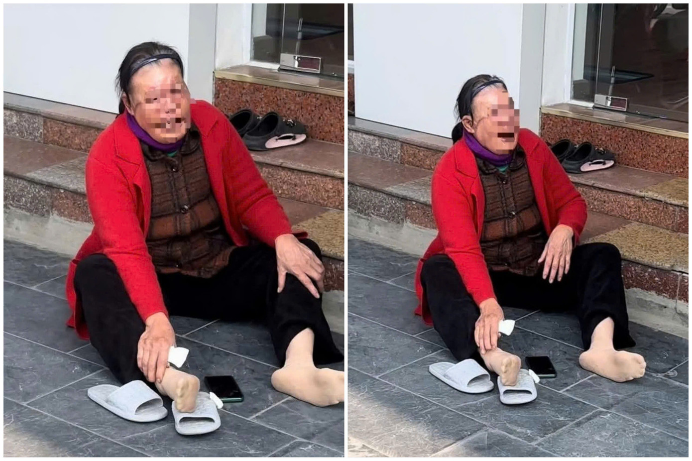 Hình ảnh người phụ nữ với khuôn mặt bị phù nề, liên tục gào khóc trước cơ sở thẩm mỹ viện. Hình ảnh người phụ nữ với khuôn mặt bị phù nề, liên tục gào khóc trước cơ sở thẩm mỹ viện.