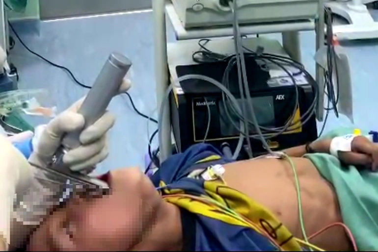 Cháu L. được bác sĩ nội soi gắp con vắt ra khỏi cơ thể