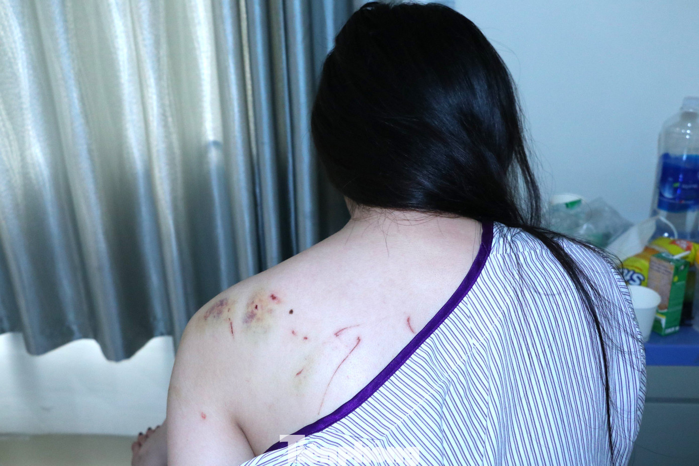 Cơ thể đầy vết thương của chị T.