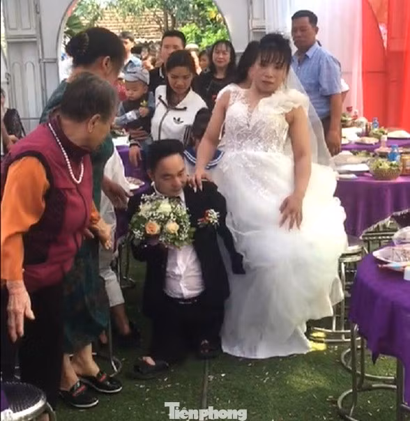 Sau một lần bị tai nạn giao thông, đôi chân của cô dâu không còn được lành lặn như trước.