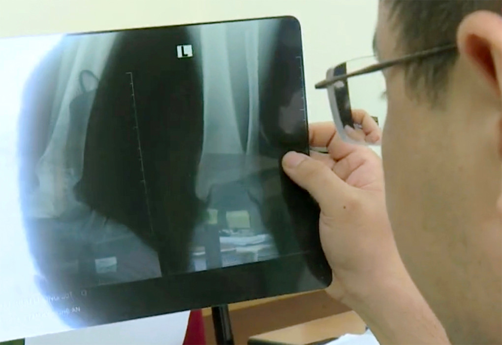 Trinh sát kiểm tra một phim X-Quang giả. Trinh sát kiểm tra một phim X-Quang giả.