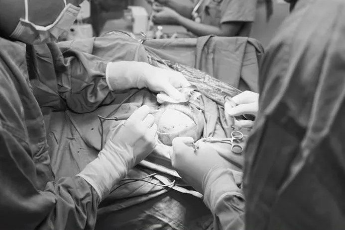 Các bác sĩ thực hiện phẫu thuật cứu bệnh nhi bị xuất huyết não