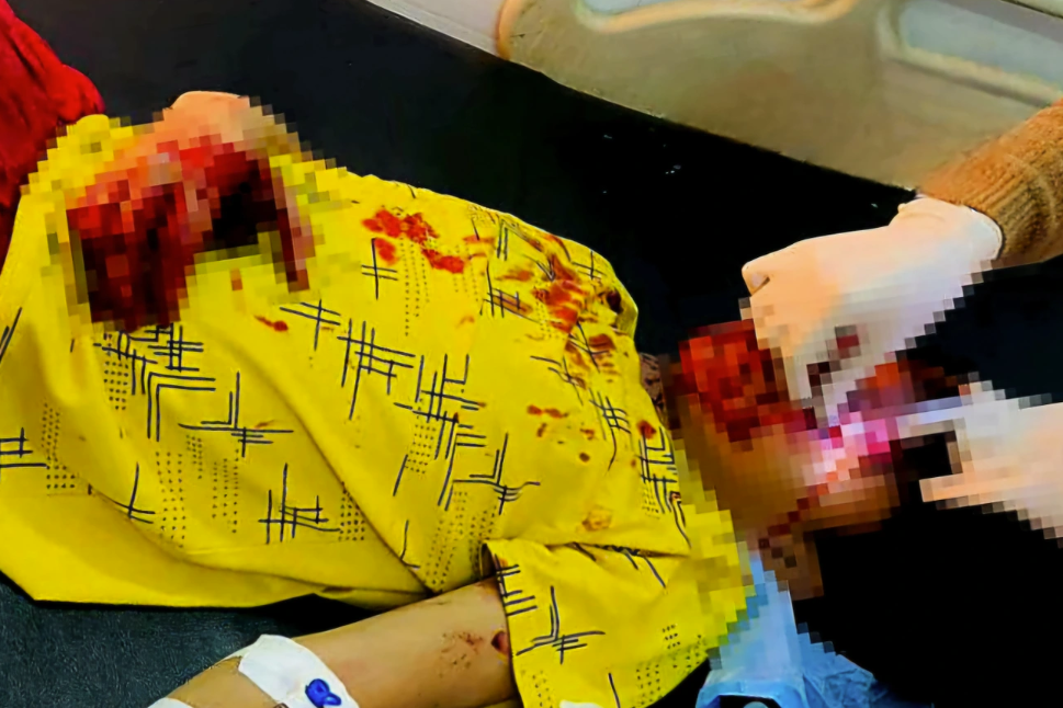 Nạn nhân được đưa vào Bệnh viện huyện Đô Lương trong tình trạng bị thương ở tay và vùng mặt