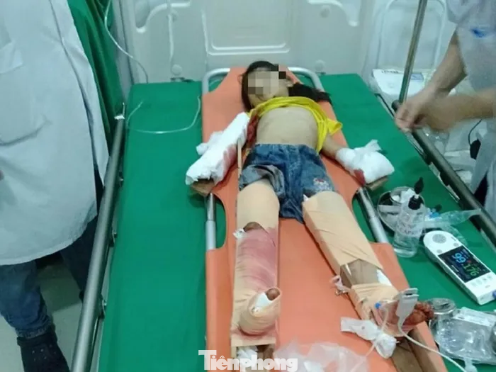 Cháu Vy bị thương nặng ở hai tay, hai chân, hiện đang hôn mê Cháu Vy bị thương nặng ở hai tay, hai chân, hiện đang hôn mê