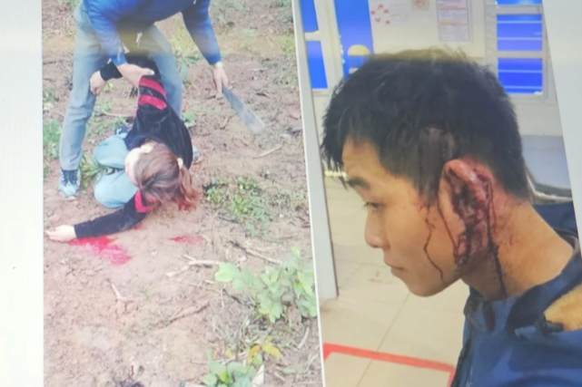 Mạng xã hội xôn xao hình ảnh hai vợ chồng bị đánh chảy máu