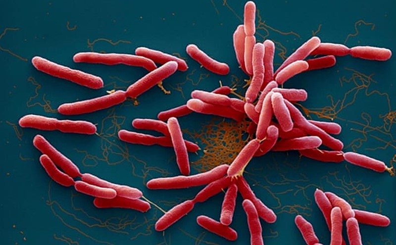 Vi khuẩn Whitmore. Ảnh minh họa