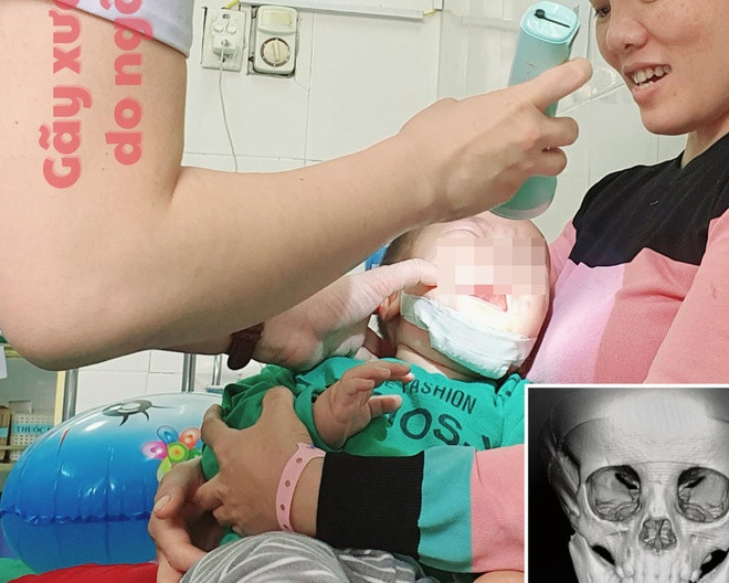 Thăm khám cho trẻ sau phẫu thuật. Thăm khám cho trẻ sau phẫu thuật.