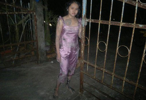 Con gái ông Sót cũng khẳng định bị người nhà bà Lý hành hung. Con gái ông Sót cũng khẳng định bị người nhà bà Lý hành hung