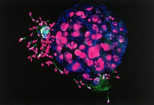 Phôi thai của con người và tinh trùng. Đó là năm ngày sau khi trứng thụ tinh, với một số tế bào tinh trùng còn lại vẫn bám xung quanh. Phôi thai của con người và tinh trùng. Đó là năm ngày sau khi trứng thụ tinh, với một số tế bào tinh trùng còn lại vẫn bám xung quanh