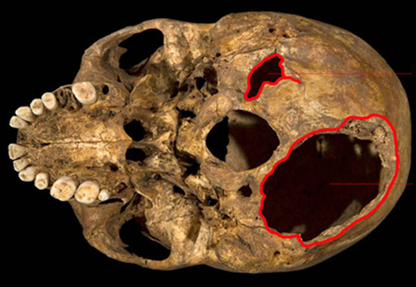 Giải mã cái chết thảm khốc của 'ông Vua gù' nước Anh ảnh 2