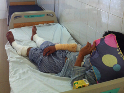 Bệnh nhân Phạm Văn T. đang điều trị tại Viện Bỏng quốc gia. Ảnh T.Hà