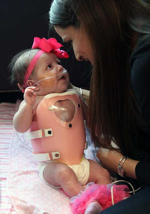 Chiếc áo hồng được thiết kế đặc biệt để bảo vệ lồng ngực cô bé Audrina sau khi phẫu thuật thành công . Chiếc áo hồng được thiết kế đặc biệt để bảo vệ lồng ngực cô bé Audrina sau khi phẫu thuật thành công