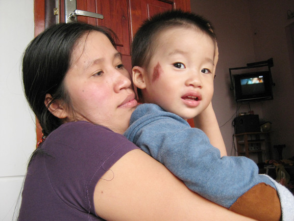 Cháu Nguyễn Quang Huy bị đánh trên mặt. Cháu Nguyễn Quang Huy bị đánh trên mặt