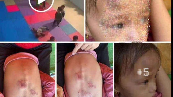 Thời gian qua nhiều trẻ bị bạo hành Thời gian qua nhiều trẻ bị bạo hành