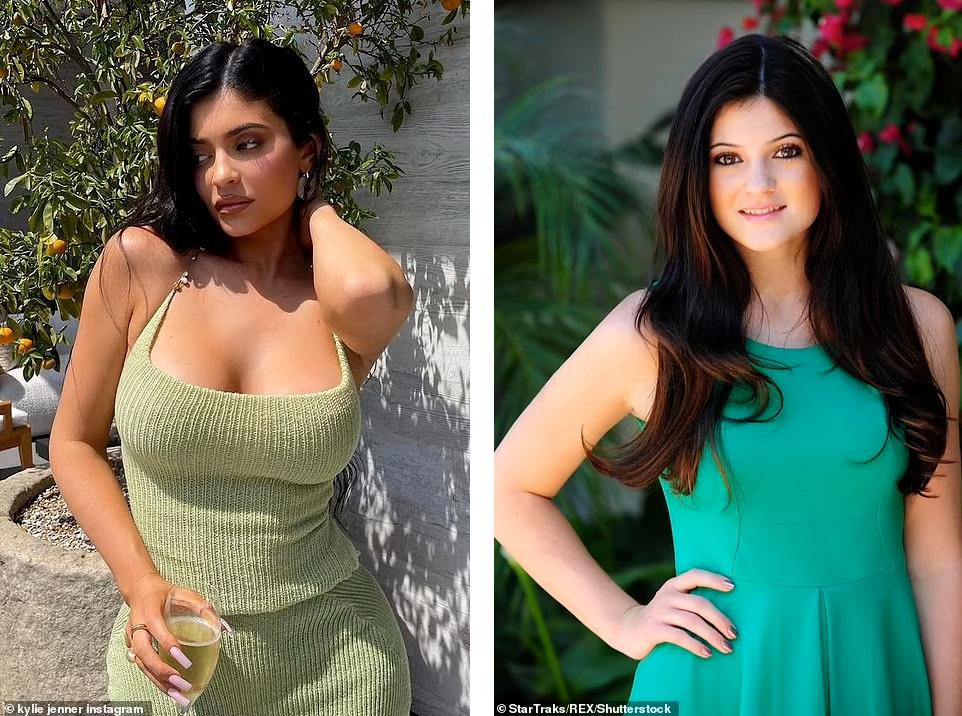 Daily Mail sau đó đã đăng bài so sánh diện mạo của Kylie hiện tại và nhiều năm về trước. Ảnh trái là em út nhà Kardashian-Jenner năm 2021 và ảnh phải chụp cô vào năm 2011. Sự khác biệt lớn nhất là đôi môi, vòng một và làn da. Kylie từng chia sẻ rất mặc cảm vì có đôi môi mỏng, đến mức cô không dám hôn ai sau khi bị tình đầu chê.