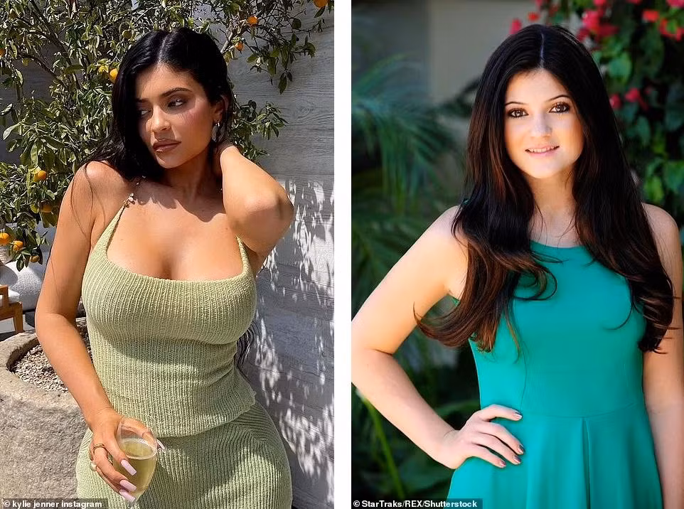 Daily Mail sau đó đã đăng bài so sánh diện mạo của Kylie hiện tại và nhiều năm về trước. Ảnh trái là em út nhà Kardashian-Jenner năm 2021 và ảnh phải chụp cô vào năm 2011. Sự khác biệt lớn nhất là đôi môi, vòng một và làn da. Kylie từng chia sẻ rất mặc cảm vì có đôi môi mỏng, đến mức cô không dám hôn ai sau khi bị tình đầu chê.