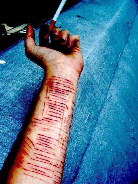 Nữ sinh viên 21 tuổi tự cắt tay 16 nhát ảnh 1