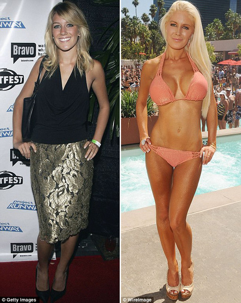 Từ khi vào nghề đến nay, ngoại hình của Heidi Montag đã thay đổi chóng mặt