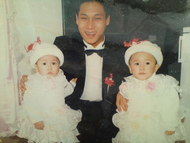 Cặp song sinh ngày nhỏ