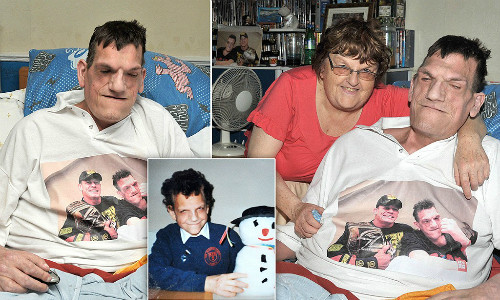 Những bệnh lạ lùng ở con người ảnh 1