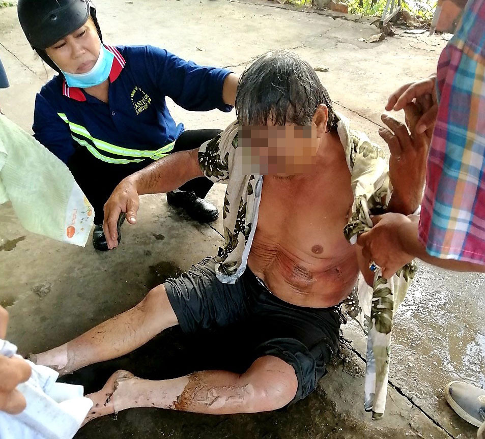 Xe cẩu va vào đường dây trung thế, một người đàn ông bị bỏng nặng ảnh 1