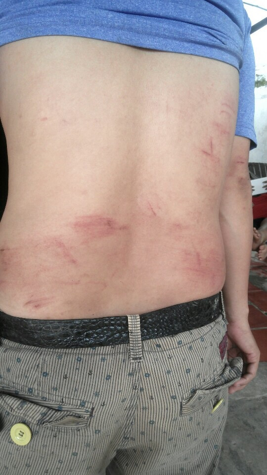 Người đàn ông bị hành hung sau khi trả lời phóng sự điều tra VTV9 ảnh 1