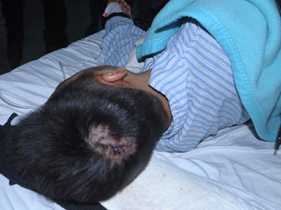 Vết thương trên đỉnh đầu của SV Thái Duy Mạnh. Ảnh: Đ.H