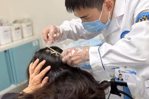 Răng kẹp càng cua ghim vào đầu người phụ nữ. Ảnh: 363Hospital. Răng kẹp càng cua ghim vào đầu người phụ nữ. Ảnh: 363Hospital.