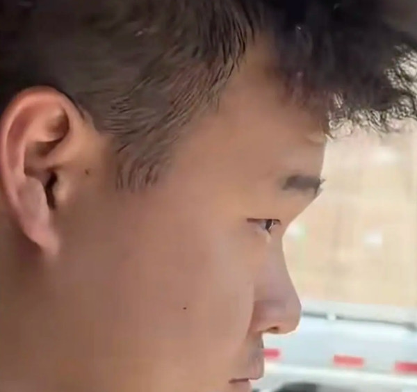 Anh Li nói, anh cứ phải cố mở to mắt khi lái xe, và điều này khiến anh càng khó tập trung hơn. Ảnh: Moretify.