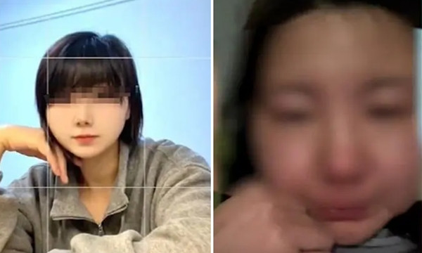 Cô Wu trước và sau khi bị nhổ nhầm răng. Ảnh: World Journal.