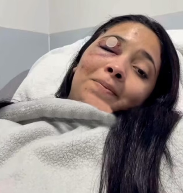 Estrada ở trong viện. Ảnh: La Prensa. Estrada ở trong viện. Ảnh: La Prensa.