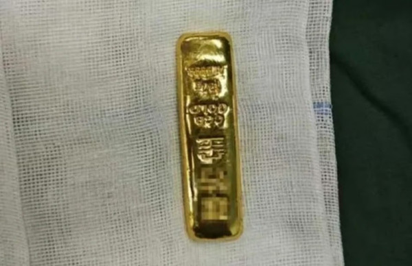 Thỏi vàng mà bé Qian đã nuốt nhưng không tiêu hóa được. Ảnh: Douyin.