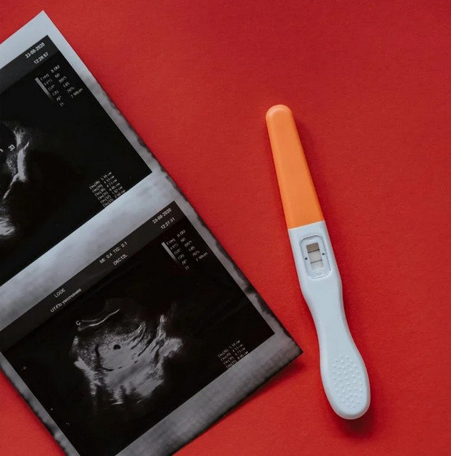 Chị Li đã mang bầu lần thứ 9. Ảnh: MSNews. Chị Li đã mang bầu lần thứ 9. Ảnh: MSNews.