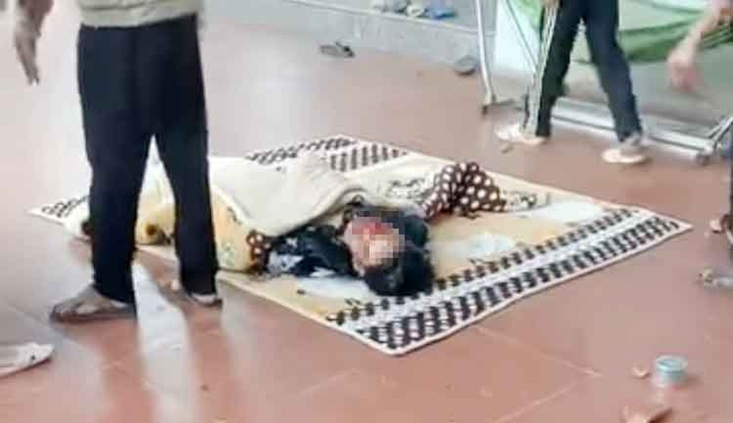 Vụ nổ khiến hai bàn tay nạn nhân dập nát, chấn thương vùng mặt.