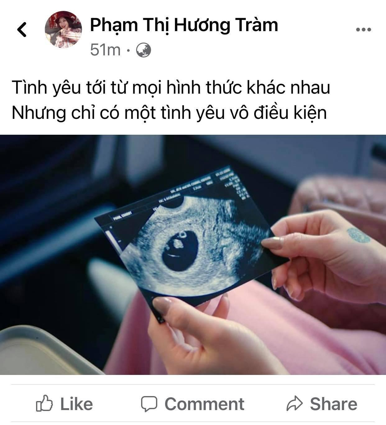 Trong vòng 1 tiếng đồng hồ, bức ảnh của Hương Tràm đạt hơn 15 nghìn lượt thích trên Facebook. Trong vòng 1 tiếng đồng hồ, bức ảnh của Hương Tràm đạt hơn 15 nghìn lượt thích trên Facebook.