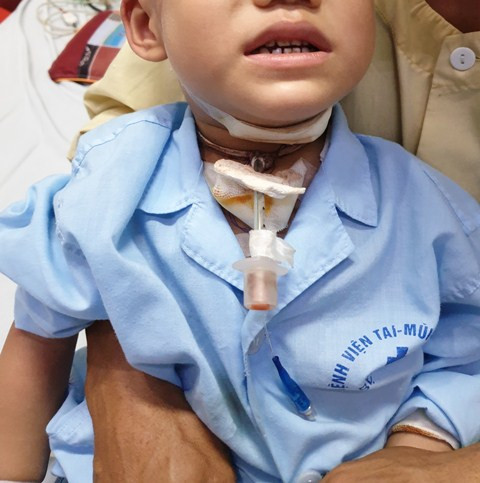 Bác sỹ chỉ cách xử trí 'sống còn' khi bị chó cắn ảnh 1