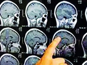 Ảnh minh họa. . Ảnh: Internet Ảnh minh họa.