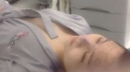 Hương Tràm lộ video trong phòng phẫu thuật thẩm mỹ.