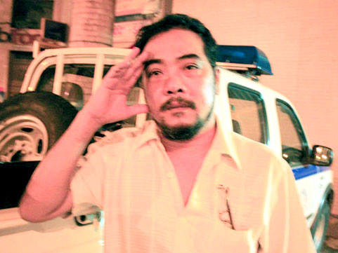 Ông Thảo chỉ vết bị hai tên cướp đánh trên đầu. Ảnh: An Nhơn (VnExpress) Ông Thảo chỉ vết bị hai tên cướp đánh trên đầu