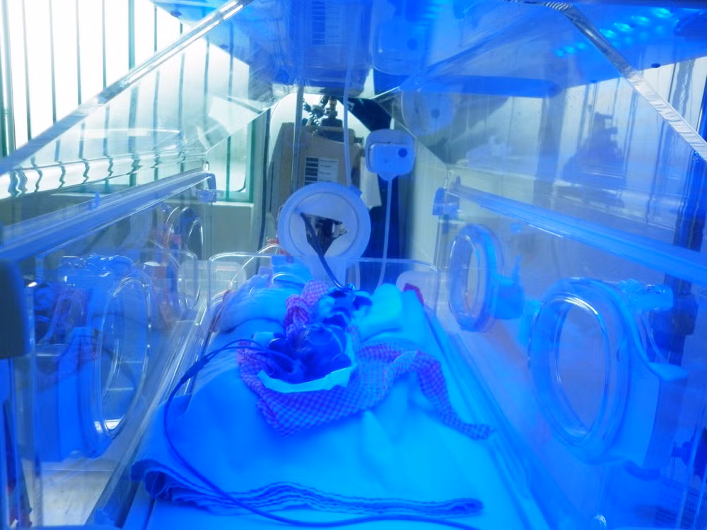 Cháu bé sơ sinh đang được điều trị nuôi dưỡng tại Bệnh viên Nhi Quảng Nam