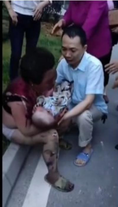 Người bà và em bé bị bỏng. Ảnh: Newsweek. Người bà và em bé bị bỏng. Ảnh: Newsweek.