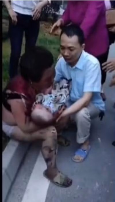 Người bà và em bé bị bỏng. Ảnh: Newsweek.